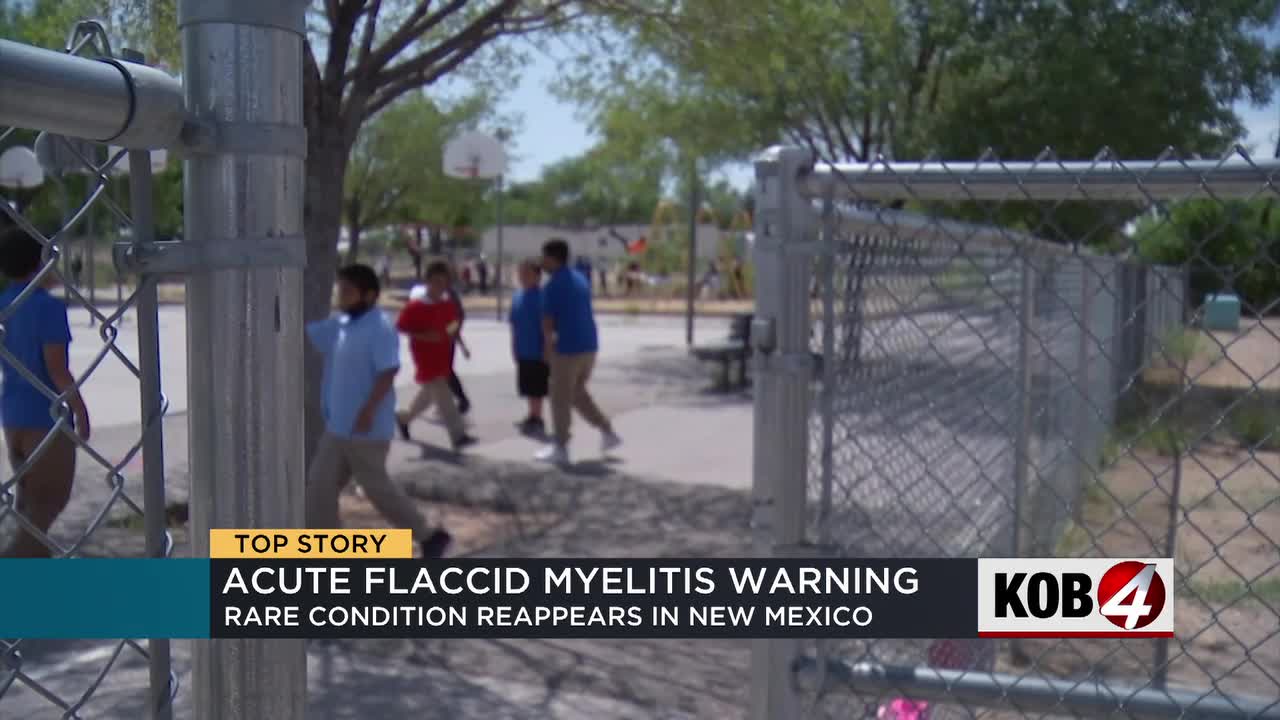 新墨西哥州卫生官员警告急性弛缓性脊髓炎